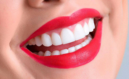 Dientes perfectos, cosmética dental