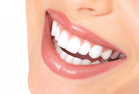 Dientes perfectos cosmetica dental