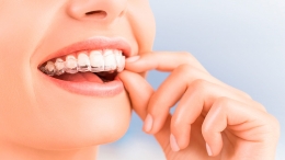 Mantenimiento de emergencia para tu ortodoncia