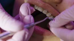Cómo cuidar tu boca cuando llevas ortodoncia